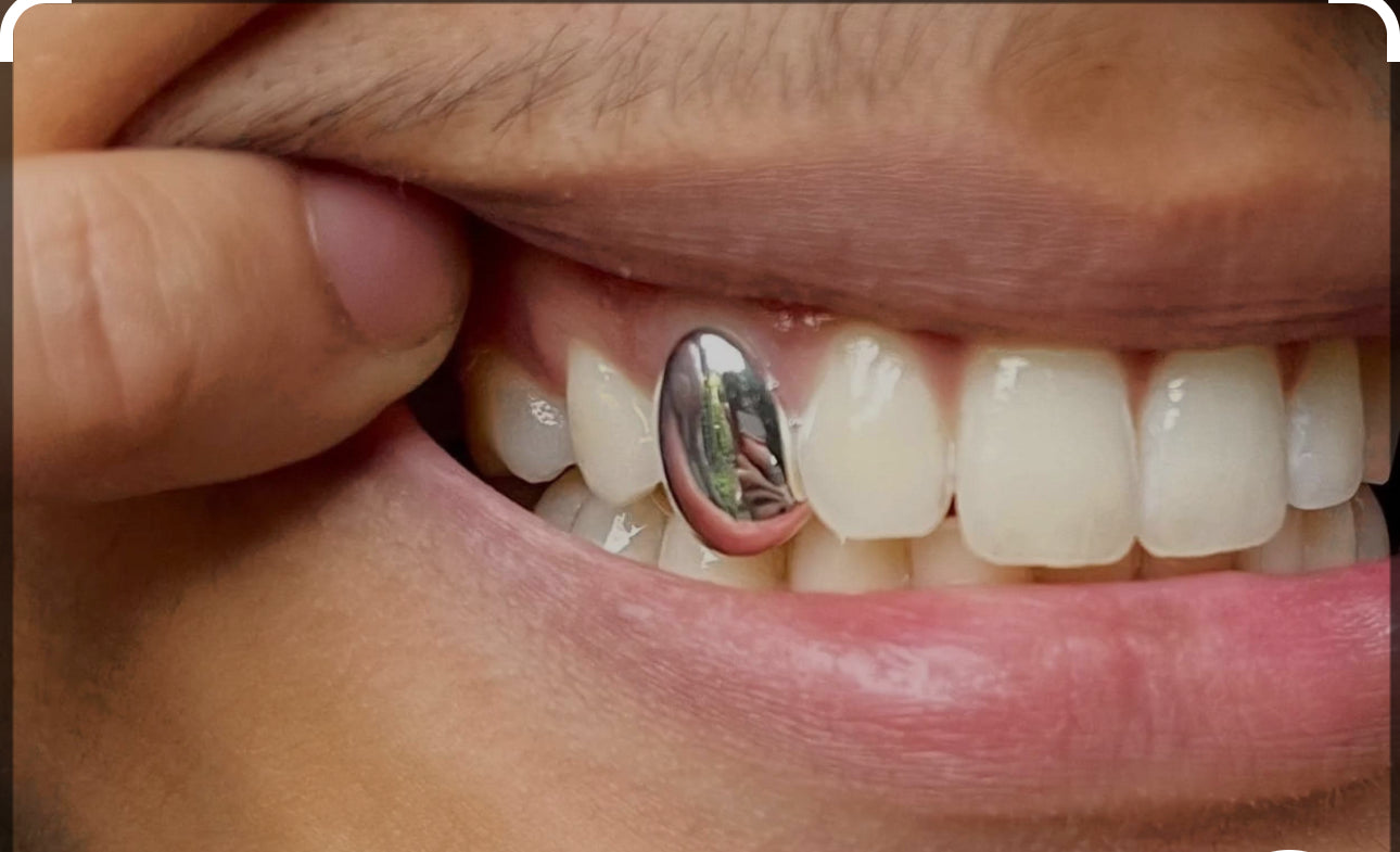 Custom Gold & Diamond Grills