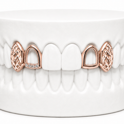 4 Teeth Diamond Cut Fang Grillz | Custom Gold Grillz | Philly Diamond Connection