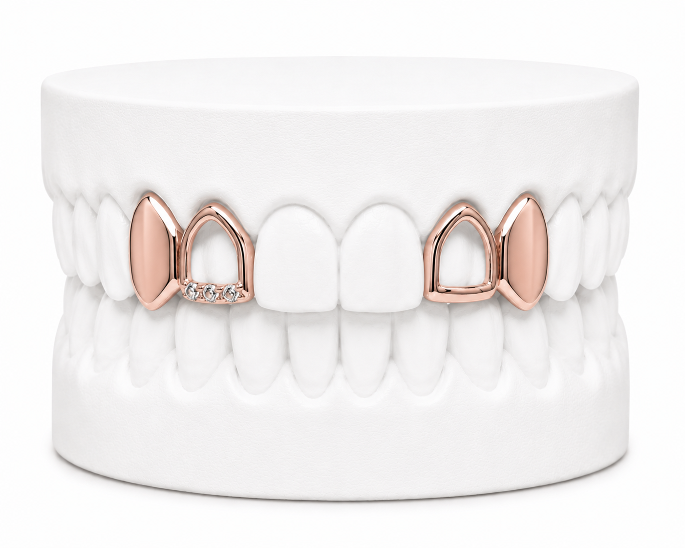 4 Teeth Grillz | Custom Gold Grillz | Philly Diamond Connection