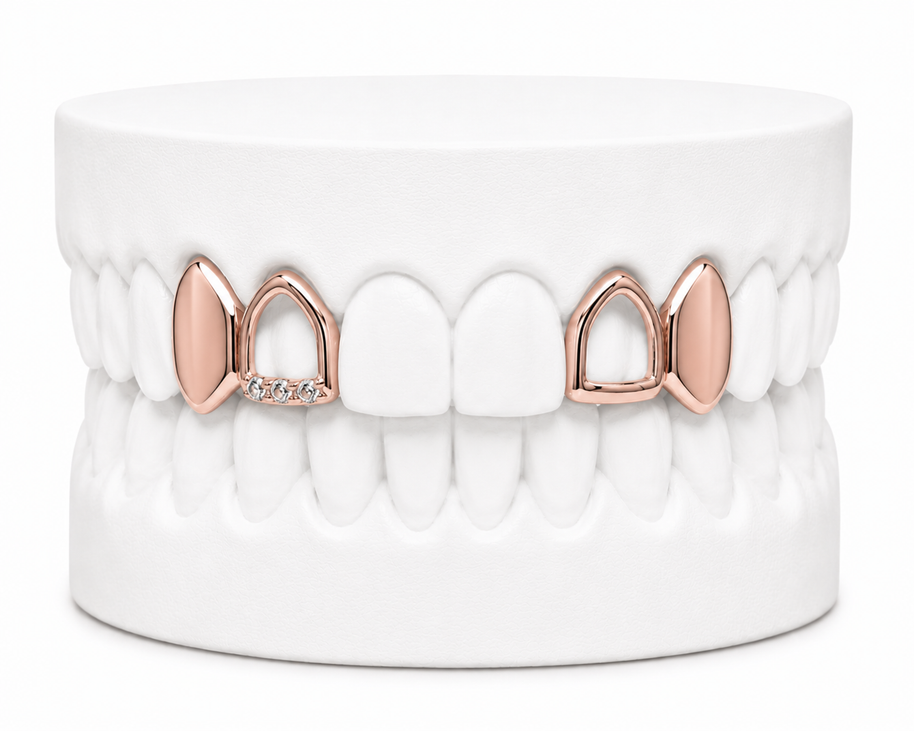 4 Teeth Grillz | Custom Gold Grillz | Philly Diamond Connection