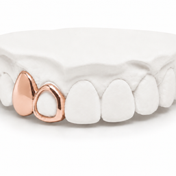 Custom 2 Tooth Open Face Grillz