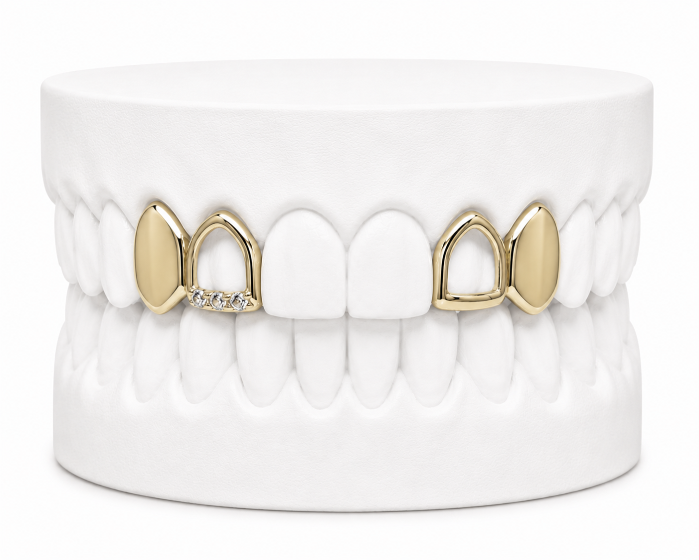 4 Teeth Grillz | Custom Gold Grillz | Philly Diamond Connection