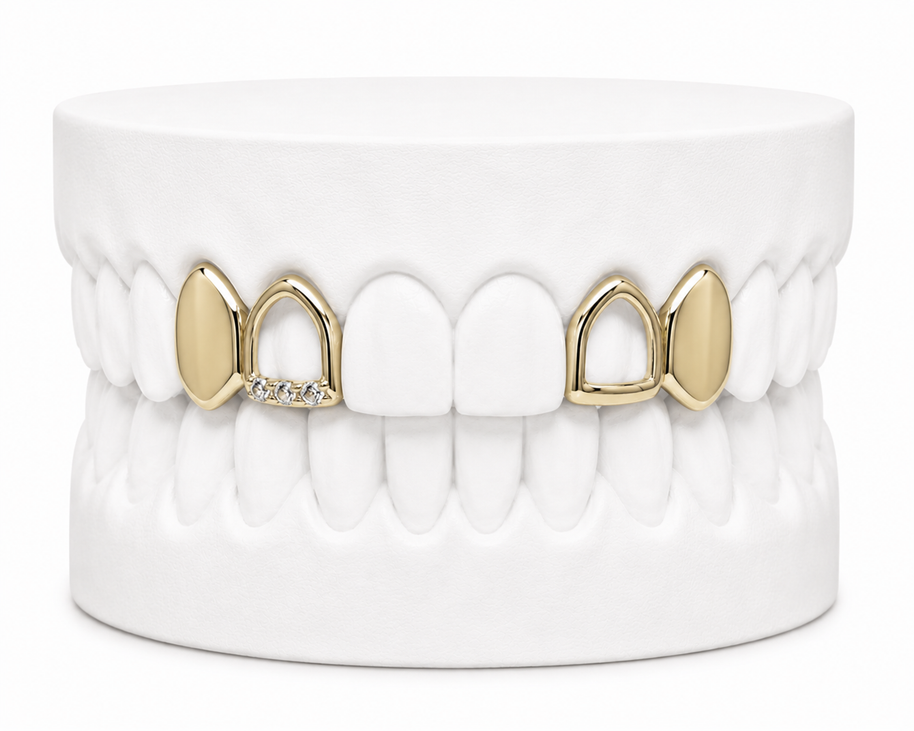 4 Teeth Grillz | Custom Gold Grillz | Philly Diamond Connection