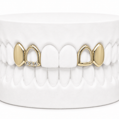 4 Teeth Grillz | Custom Gold Grillz | Philly Diamond Connection
