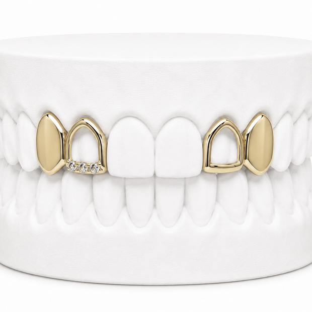4 Teeth Grillz | Custom Gold Grillz | Philly Diamond Connection