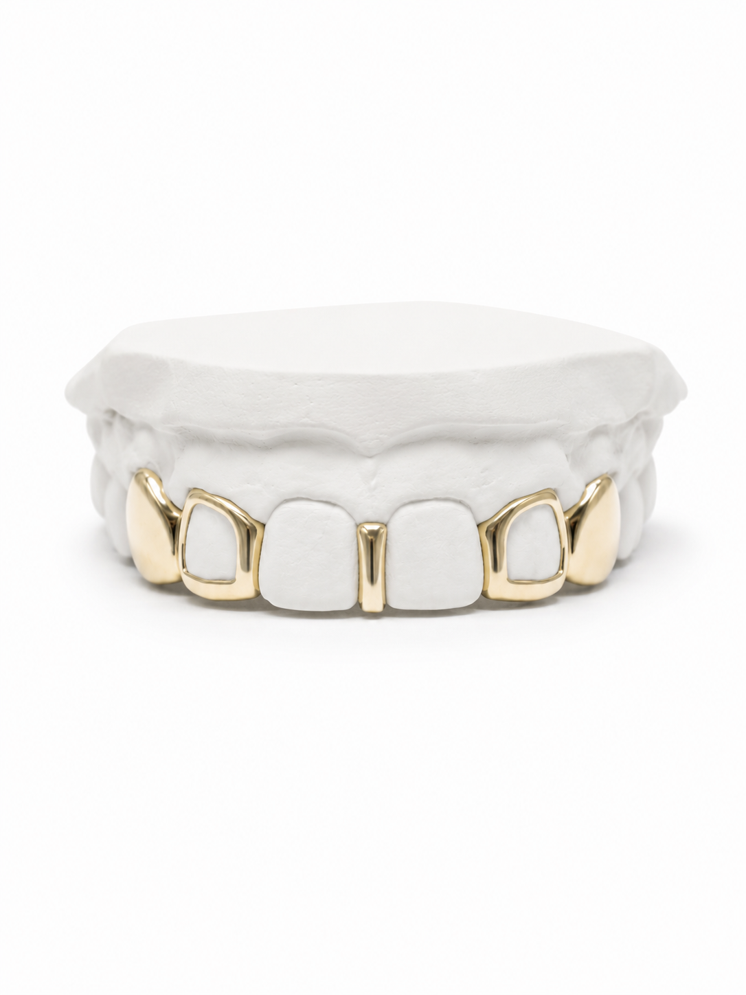 Emani Trendsetter Grillz | Custom Gold Grillz | Philly Diamond Connection