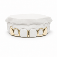 Emani Trendsetter Grillz | Custom Gold Grillz | Philly Diamond Connection