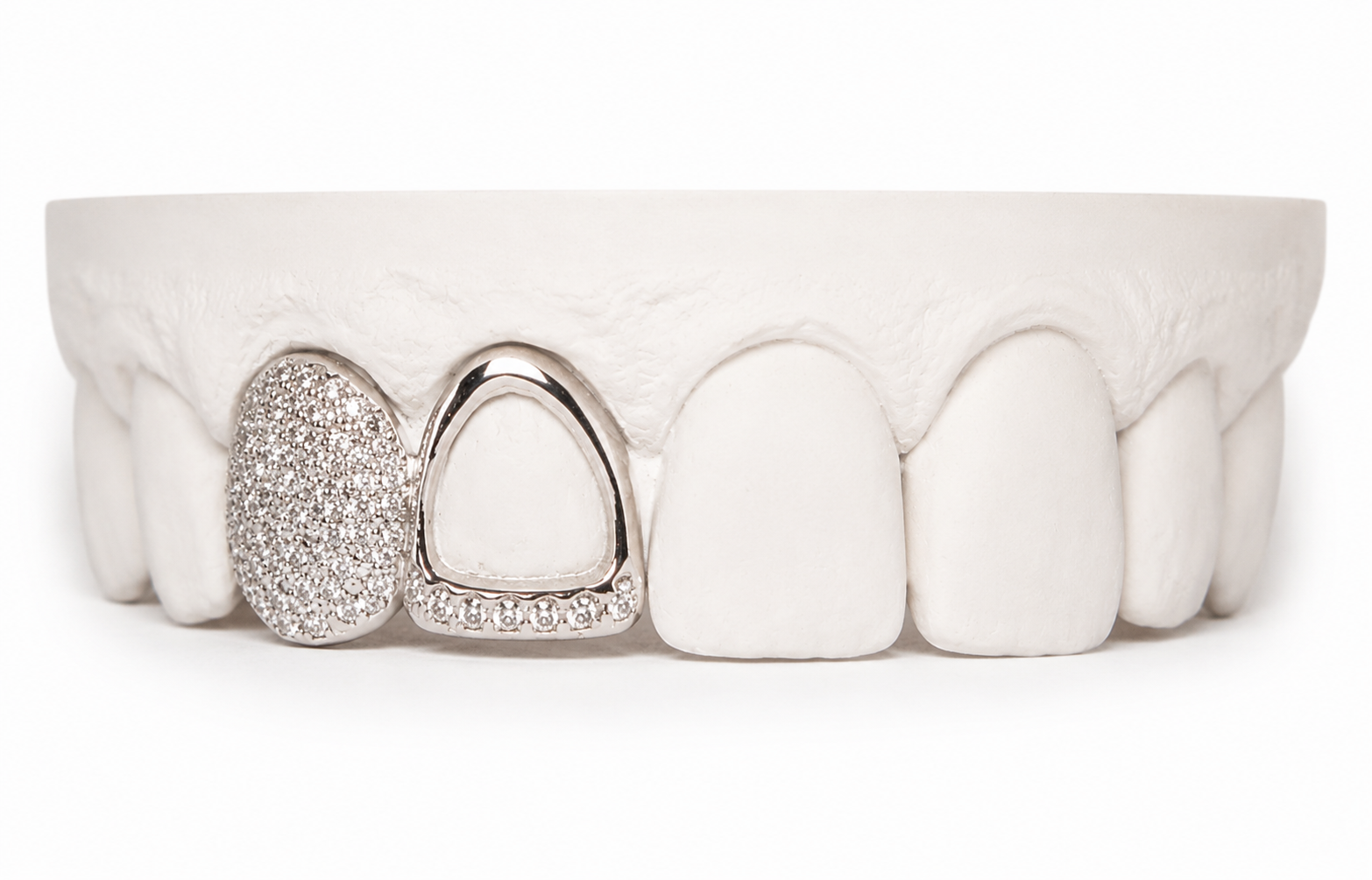 Custom Diamond Open Face Grillz | Philly Diamond Connection