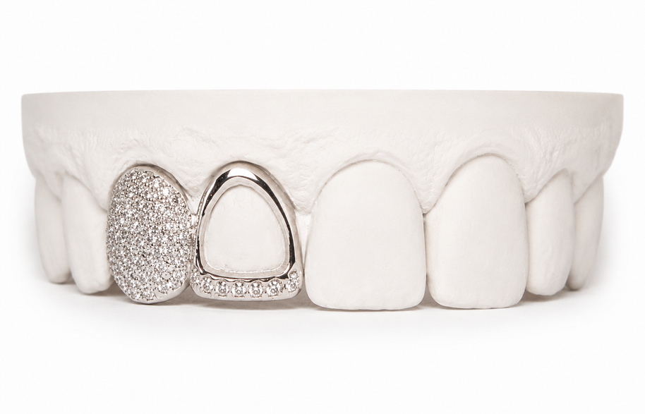 Custom Diamond Open Face Grillz | Philly Diamond Connection