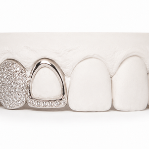 Custom Diamond Open Face Grillz | Philly Diamond Connection