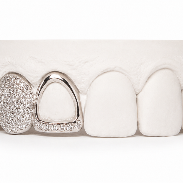 Custom Diamond Open Face Grillz | Philly Diamond Connection