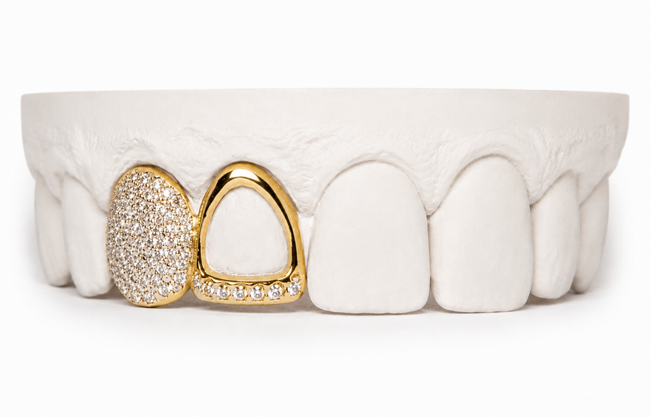 Custom Diamond Open Face Grillz | Philly Diamond Connection