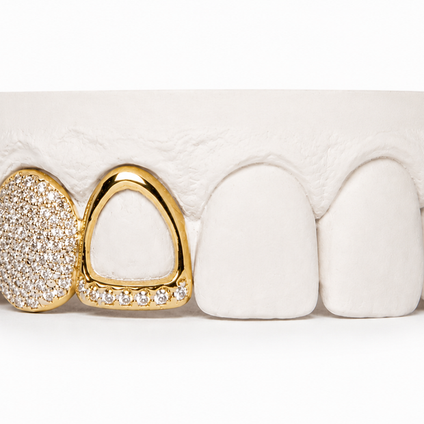 Custom Diamond Open Face Grillz | Philly Diamond Connection