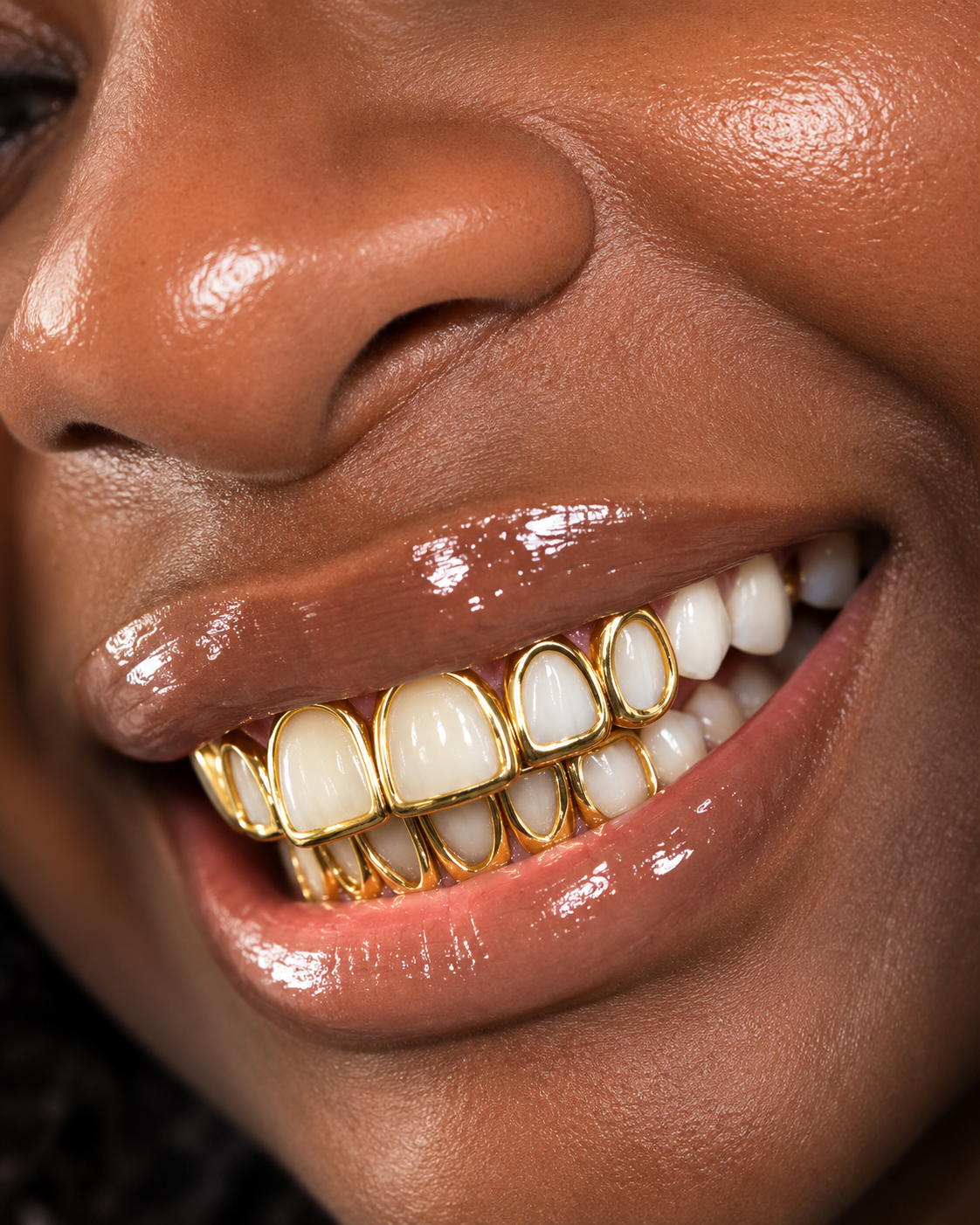 Custom Open Face Grillz | 1–8 Teeth