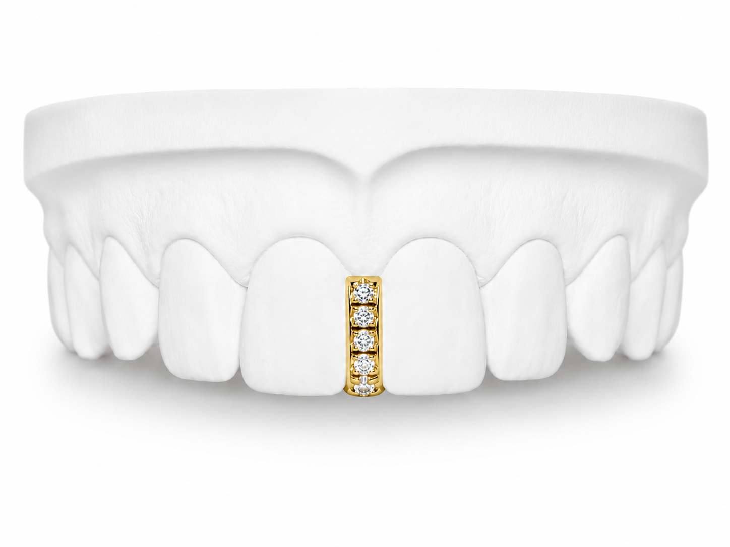 Custom Diamond Bar Grillz in 10K gold