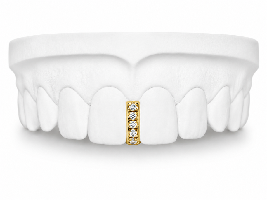 Custom Diamond Bar Grillz in 10K gold