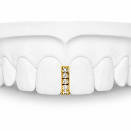 Custom Diamond Bar Grillz in 10K gold