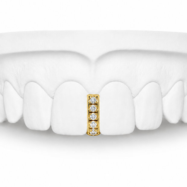 Custom Diamond Bar Grillz in 10K gold