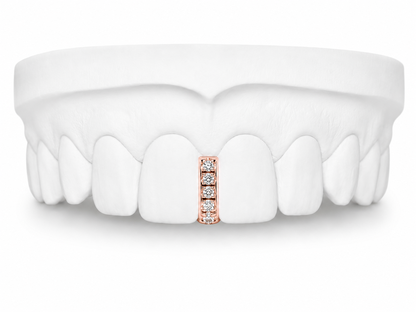 Custom Diamond Bar Grillz in rose gold