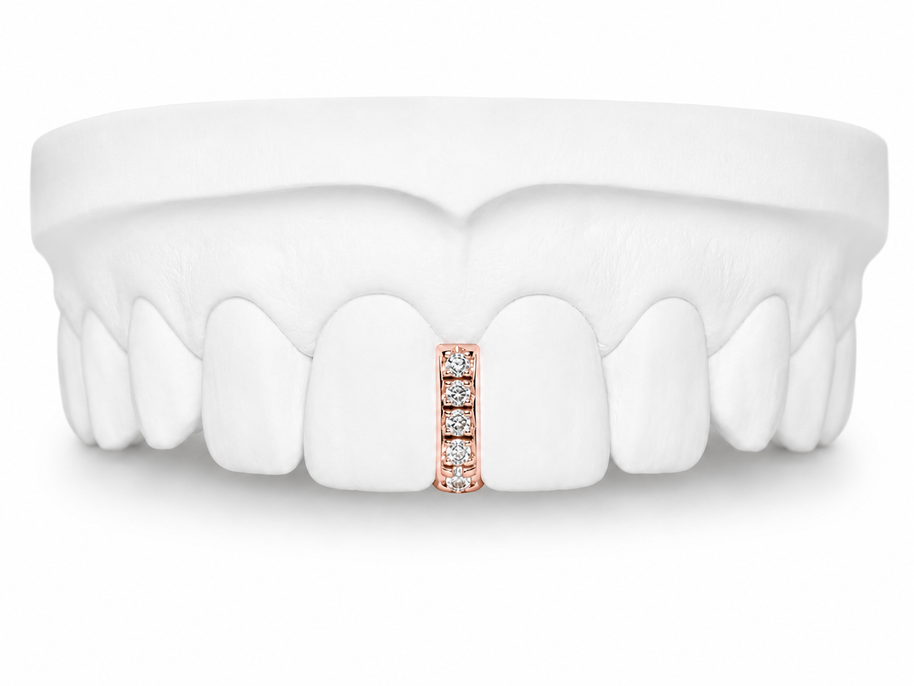 Custom Diamond Bar Grillz in rose gold