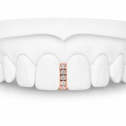Custom Diamond Bar Grillz in rose gold