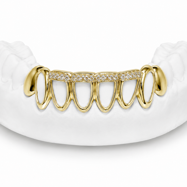 Custom open face diamond bar bottom grillz in 10K gold