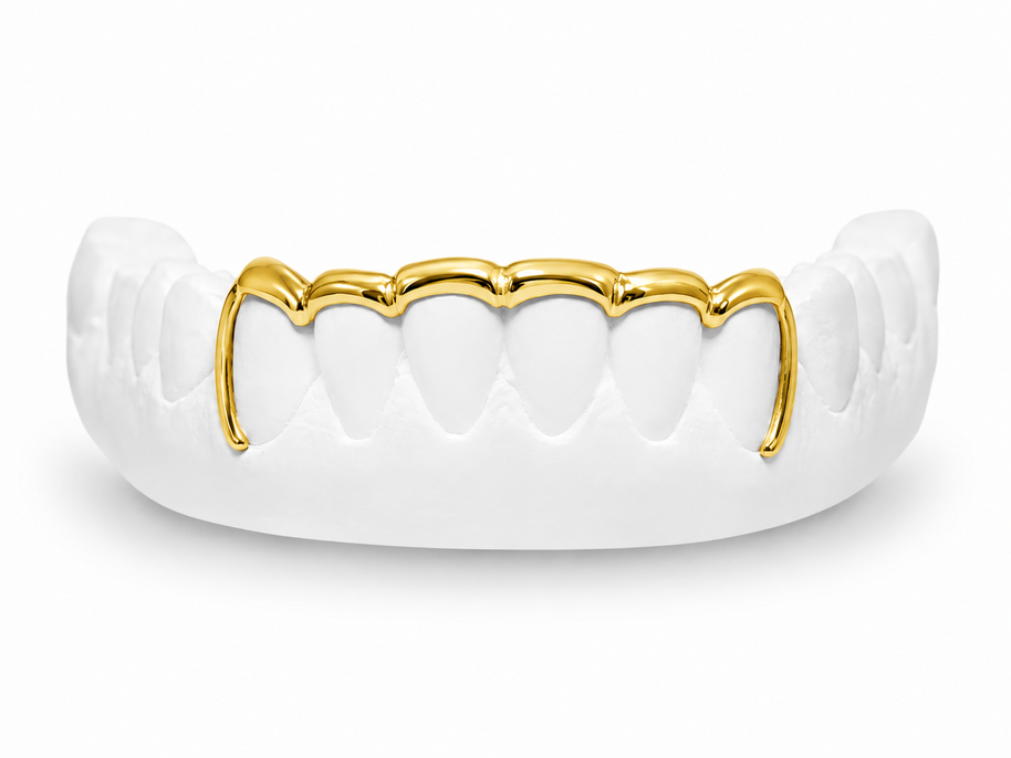 Custom scalloped bar open face bottom grillz in 10K gold
