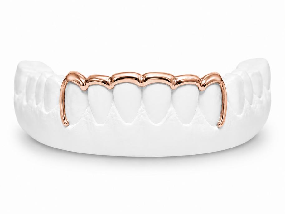 Custom scalloped bar open face bottom grillz in rose gold